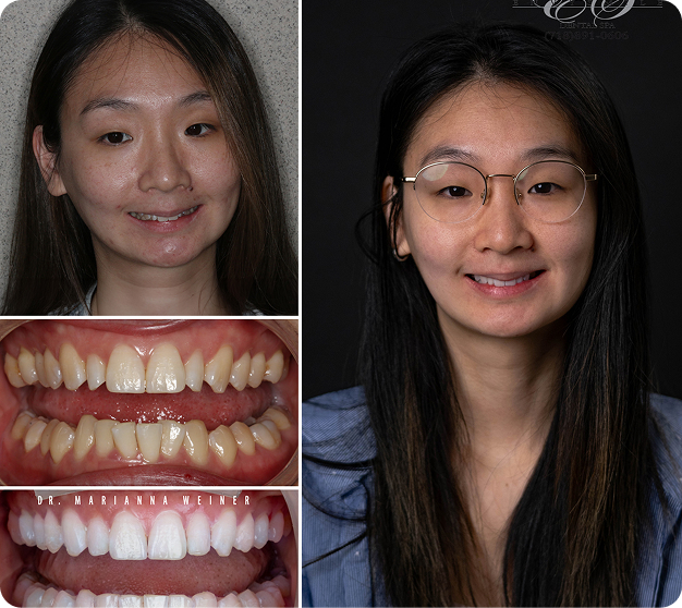 April Before & After