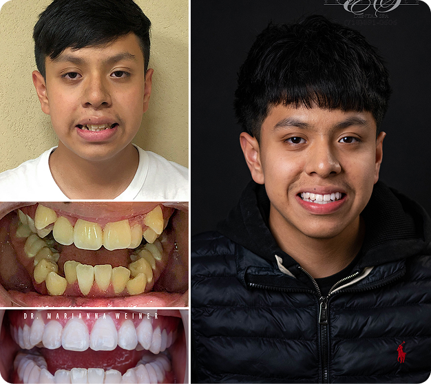 Daniel Before & After