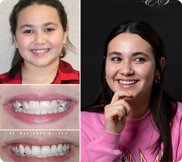 Erika Before & After