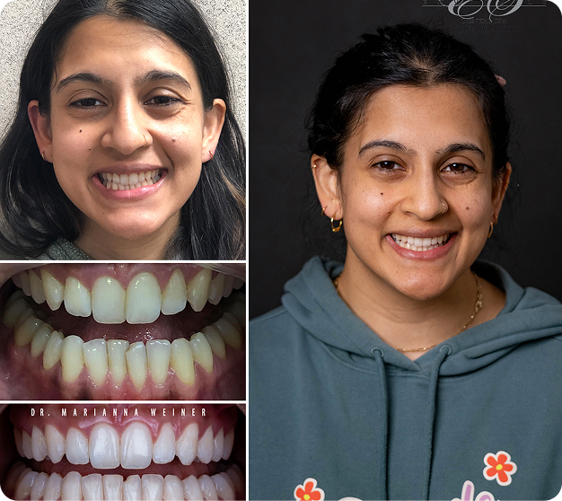 Ida Before & After