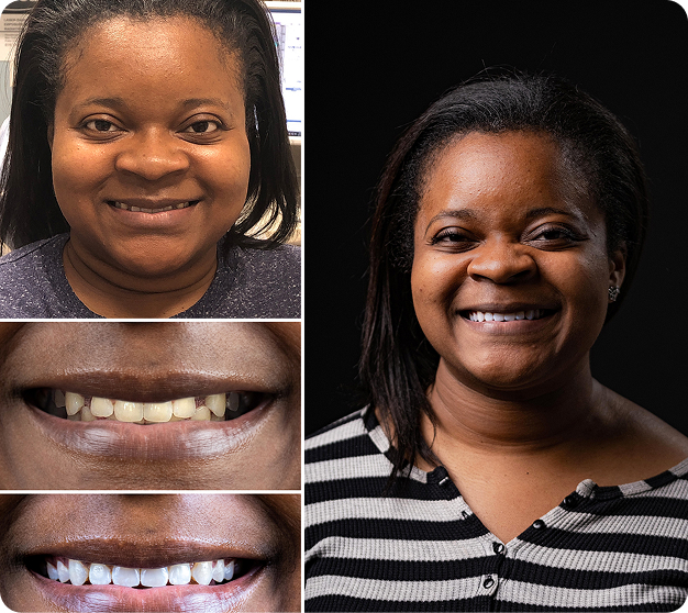 Jacqui Before & After