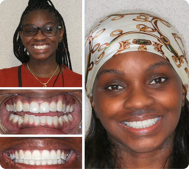 Jasmine Before & After