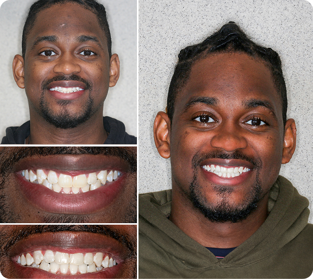 Jovin Before & After