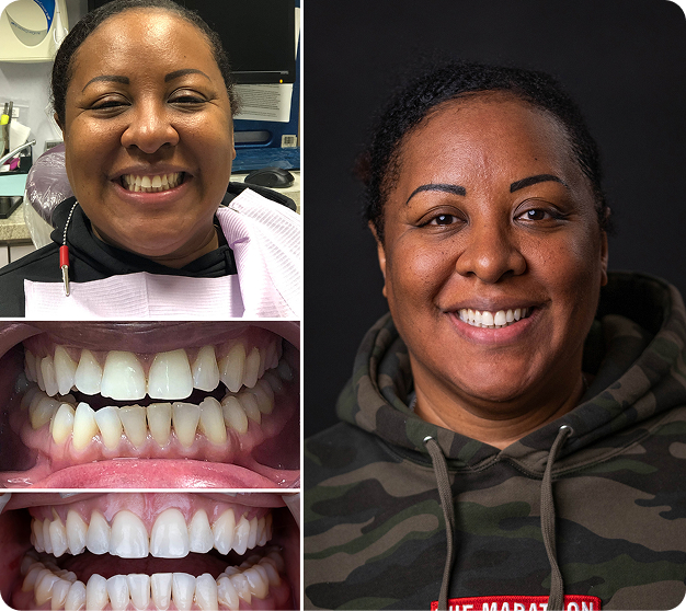 Julie Before & After
