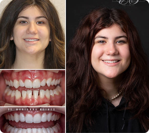 Melissa Before & After