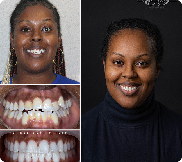 Natasha Before & After