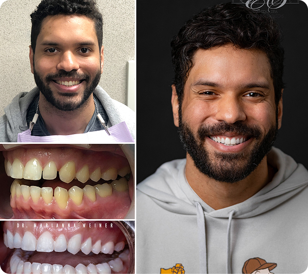 Ricardo Before & After