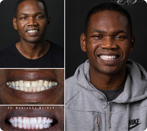 Romaine Before & After