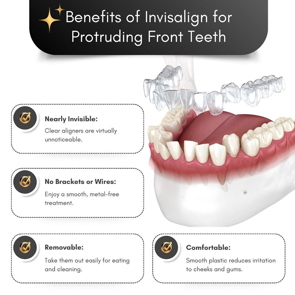 Benefits of Invisalign For Protruding Front Teeth
