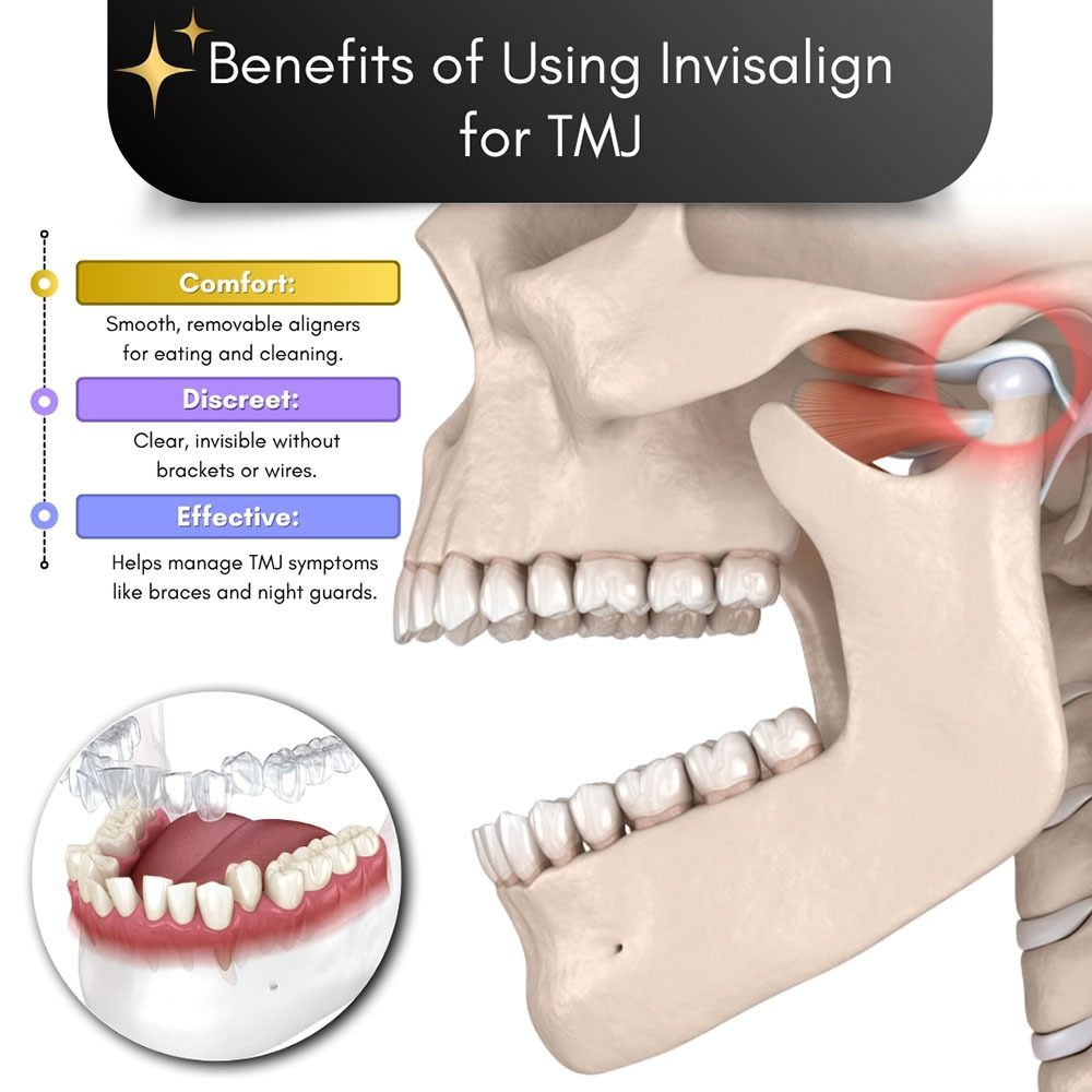 Benefits of Using Invisalign For TMJ Brooklyn