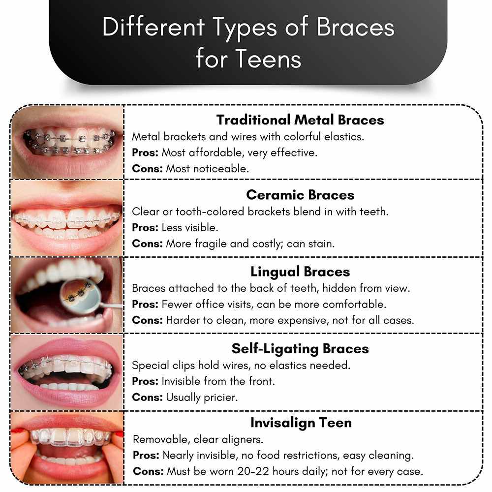 Different Types of Braces For Teens in Brooklyn