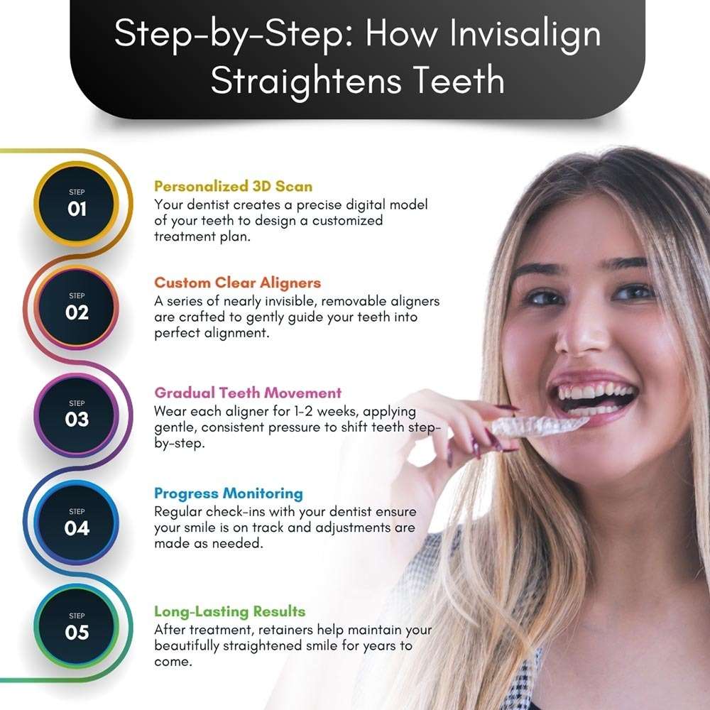 How Invisalign Straightens Teeth Brooklyn
