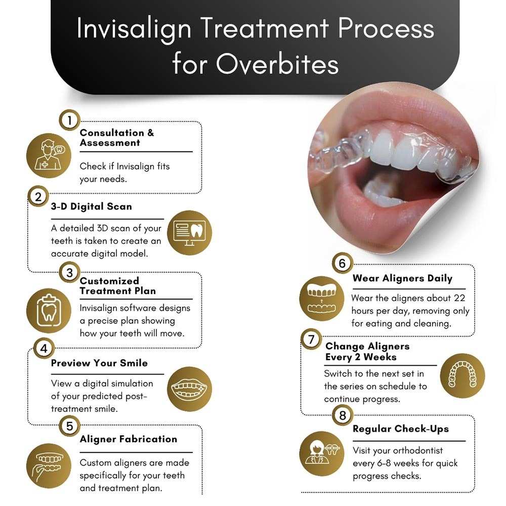 Invisalign For an Overbite in Brooklyn