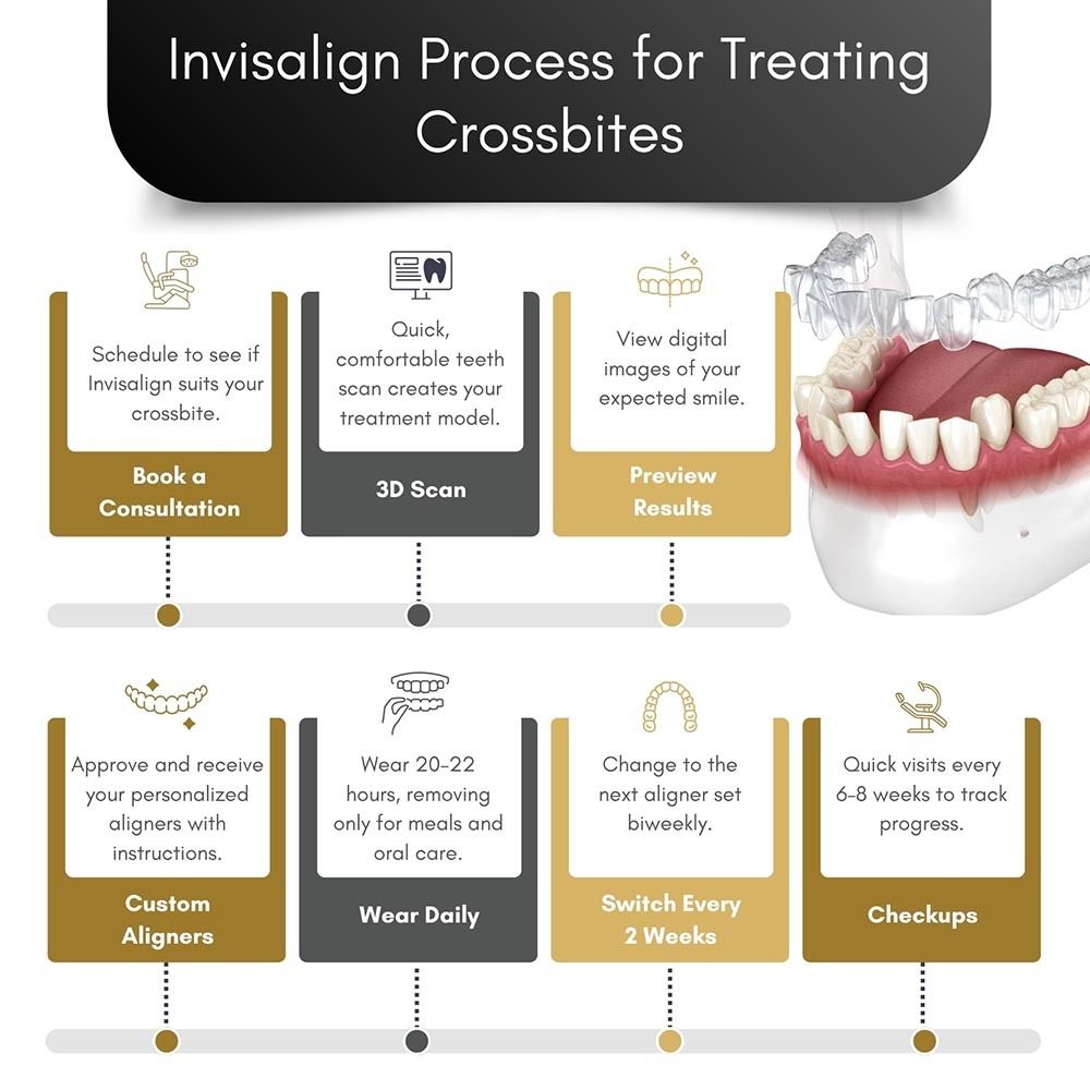 Invisalign Process For Treating Crossbites