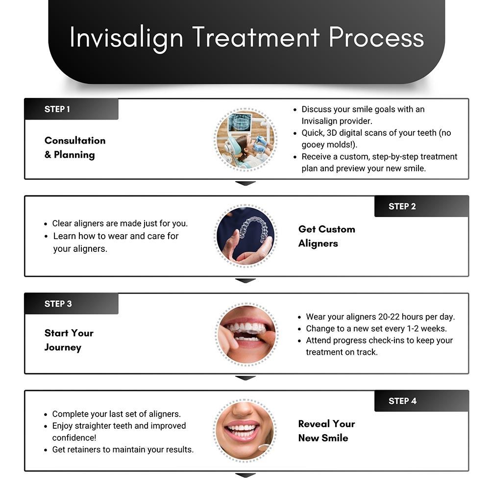 Invisalign Treatment Process in Brooklyn