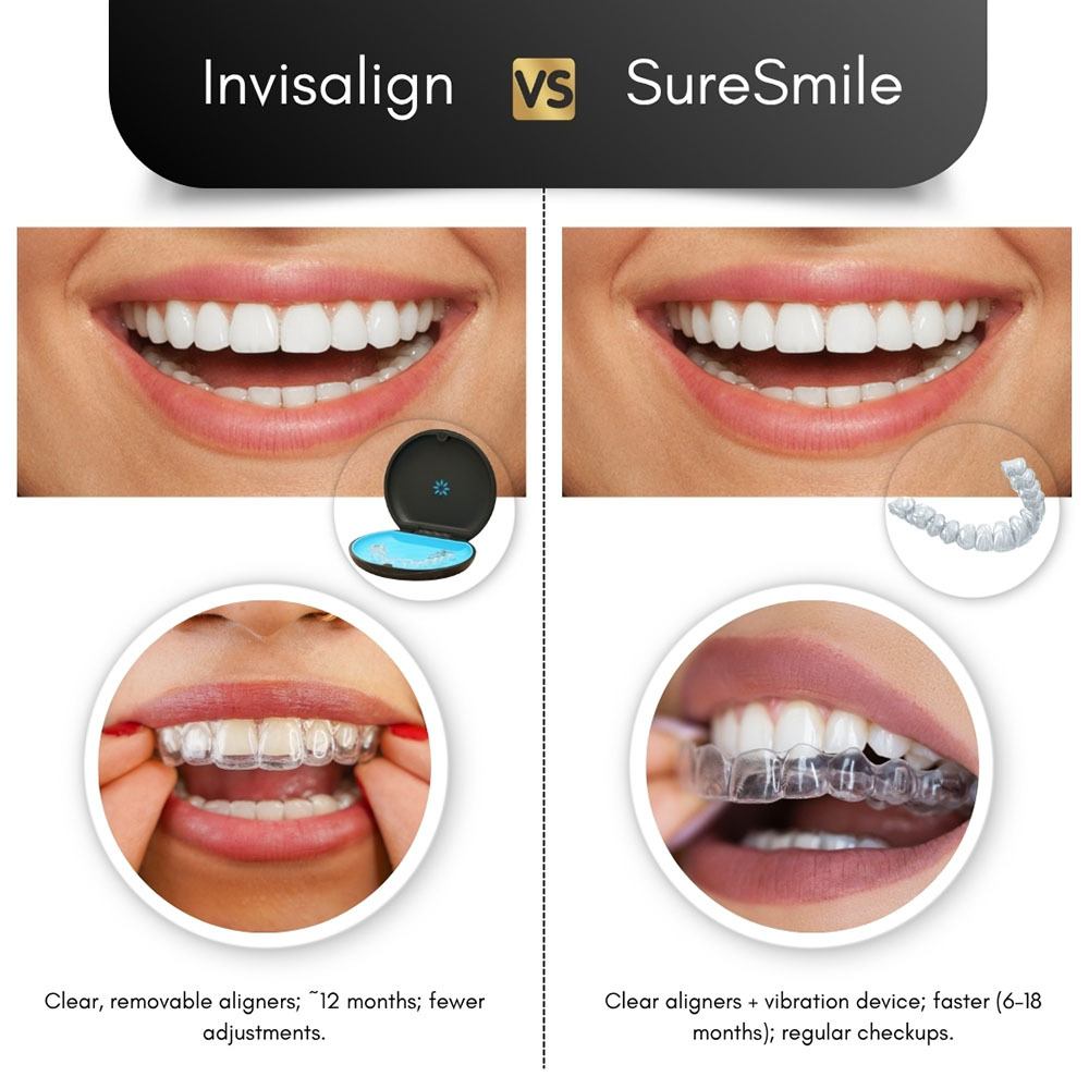 Invisalign vs Suresmile Comparison Brooklyn