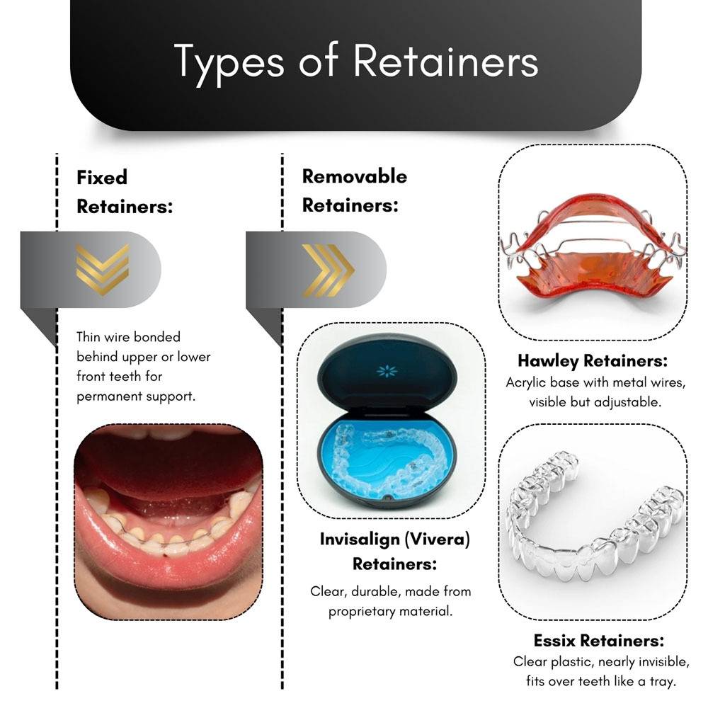 Orthodontic Retainer Options Brooklyn